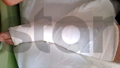 Αίγιο:-Σοκάρουν-τα-τραύματα-από-τα-σκάγια-που-δέχθηκε-15χρονος-όταν-46χρονος-πυροβόλησε-πισώπλατα-ανηλίκους