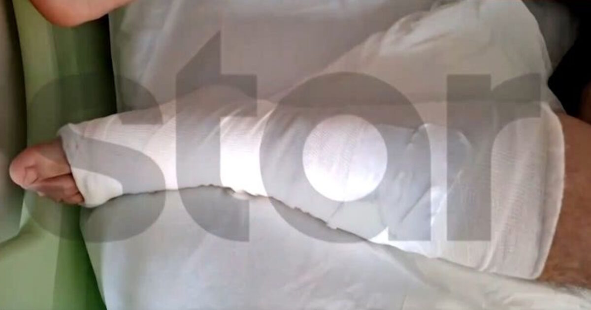 Αίγιο:-Σοκάρουν-τα-τραύματα-από-τα-σκάγια-που-δέχθηκε-15χρονος-όταν-46χρονος-πυροβόλησε-πισώπλατα-ανηλίκους