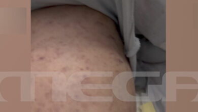 Πάτρα:-«Δεν-ήρθε-παιδίατρος-και-κάλεσα-την-αστυνομία»-λέει-η-μητέρα-του-βρέφους-που-είναι-διασωληνωμένο-με-μηνιγγίτιδα