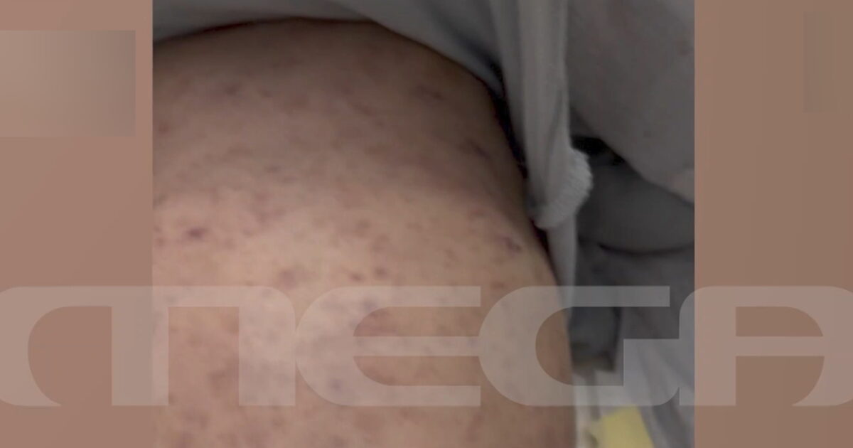 Πάτρα:-«Δεν-ήρθε-παιδίατρος-και-κάλεσα-την-αστυνομία»-λέει-η-μητέρα-του-βρέφους-που-είναι-διασωληνωμένο-με-μηνιγγίτιδα