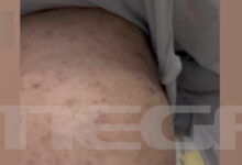 Σε-αναστολή-η-παιδίατρος-για-την-υπόθεση-του-βρέφους-που-νοσηλεύεται-με-μηνιγγίτιδα-σε-ΜΕΘ-στην-Πάτρα