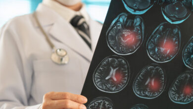 Φάρμακο-βοηθά-στην-μείωση-των-επαναλαμβανόμενων-εγκεφαλικών-επεισοδίων-–-Ο-ρόλος-της-Ελλάδας-στη-μελέτη