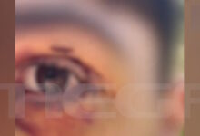 Ιωάννινα:-Άγριος-ξυλοδαρμός-16χρονου-από-ανήλικους-–-«Πήγε-βόλτα-και-κινδύνευσε-να-χάσει-την-όρασή-του»-λέει-η-μητέρα-του