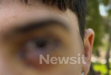 Ξυλοδαρμός-στα-Ιωάννινα:-17-ράμματα-στο-μάτι-έκανε-ο-16χρονος-–-«Τον-χτύπησαν-με-μίσος,-έχει-υποστεί-βλάβη»