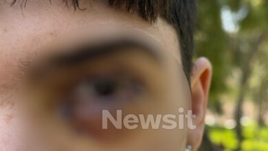 Ξυλοδαρμός-στα-Ιωάννινα:-17-ράμματα-στο-μάτι-έκανε-ο-16χρονος-–-«Τον-χτύπησαν-με-μίσος,-έχει-υποστεί-βλάβη»