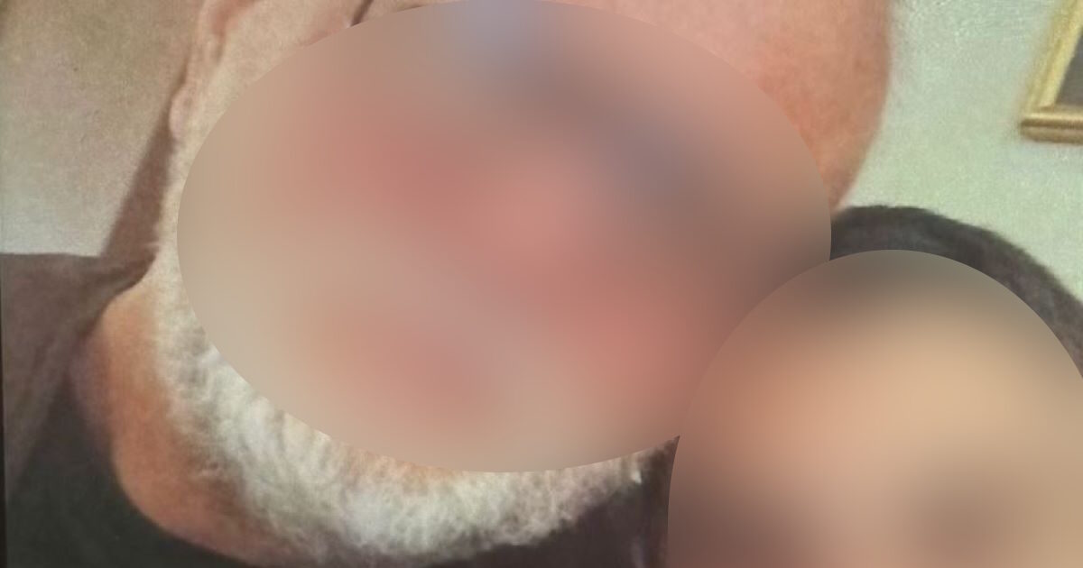 Βέροια:-«Το-παιδί-είναι-σε-πολύ-άσχημη-κατάσταση,-βρίσκεται-ακόμα-σε-κώμα»-λέει-ο-πατέρας-της-24χρονης-για-τον-ξυλοδαρμό-από-τον-20χρονο