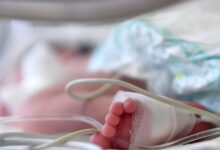 Ηλεία:-Ιατροδικαστής-εξέτασε-το-10-μηνών-βρέφος-για-να-διαπιστώσει-πως-προκλήθηκαν-τα-κατάγματα-και-οι-δαγκωματιές